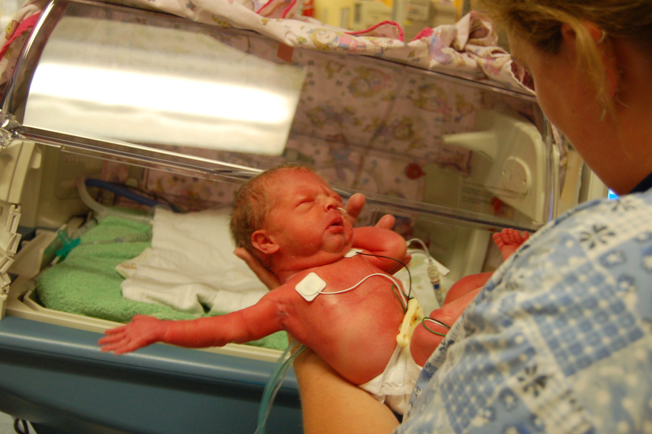 a baby in NICU